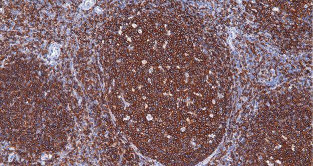 14 - CD19 AD80005