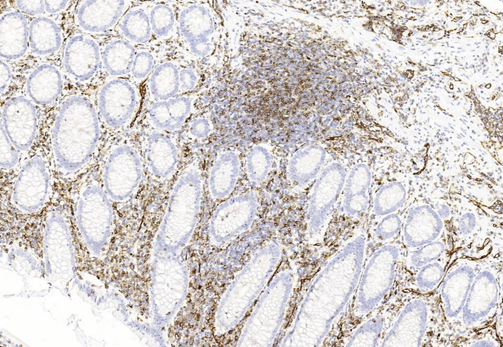 14 - CD31 AD80007