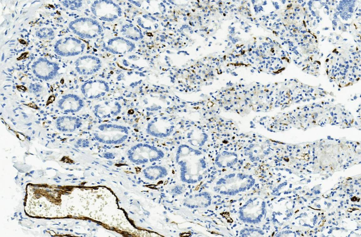 14 - CD31 AD80007