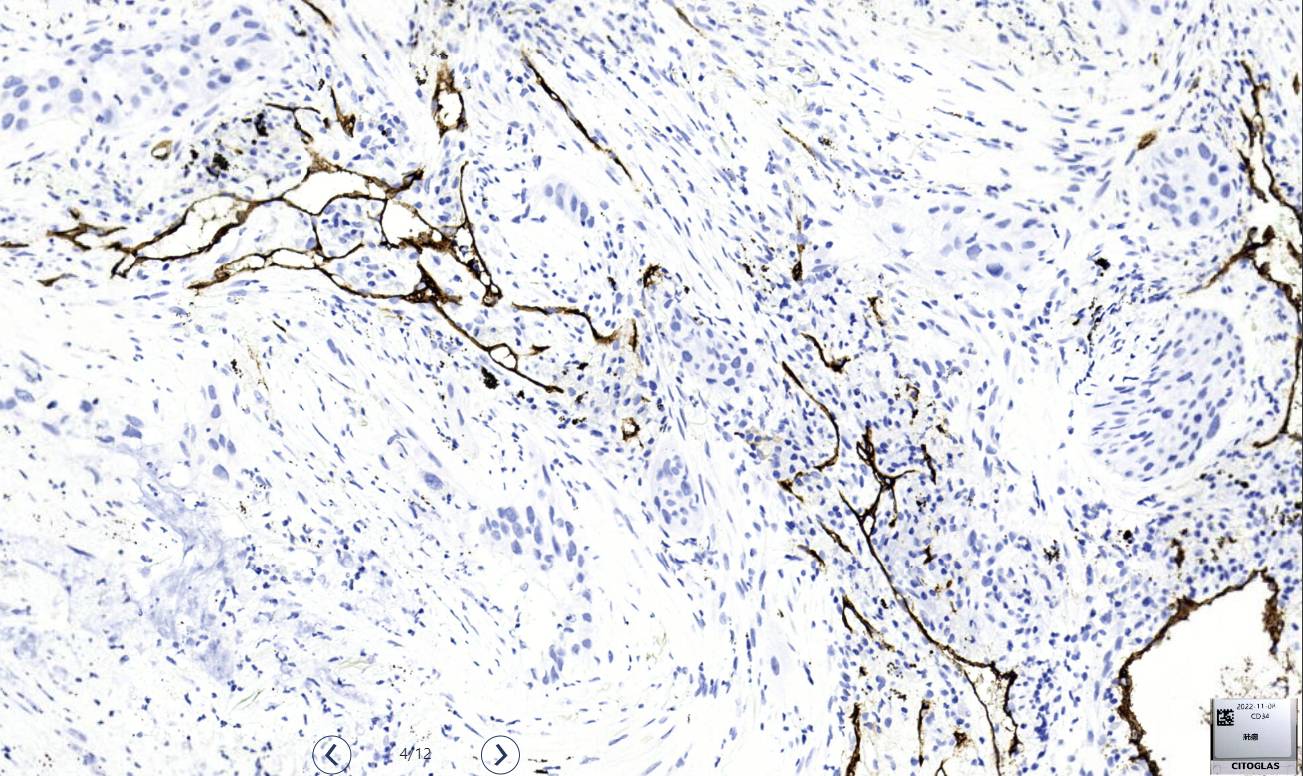14 - CD34 AD80008