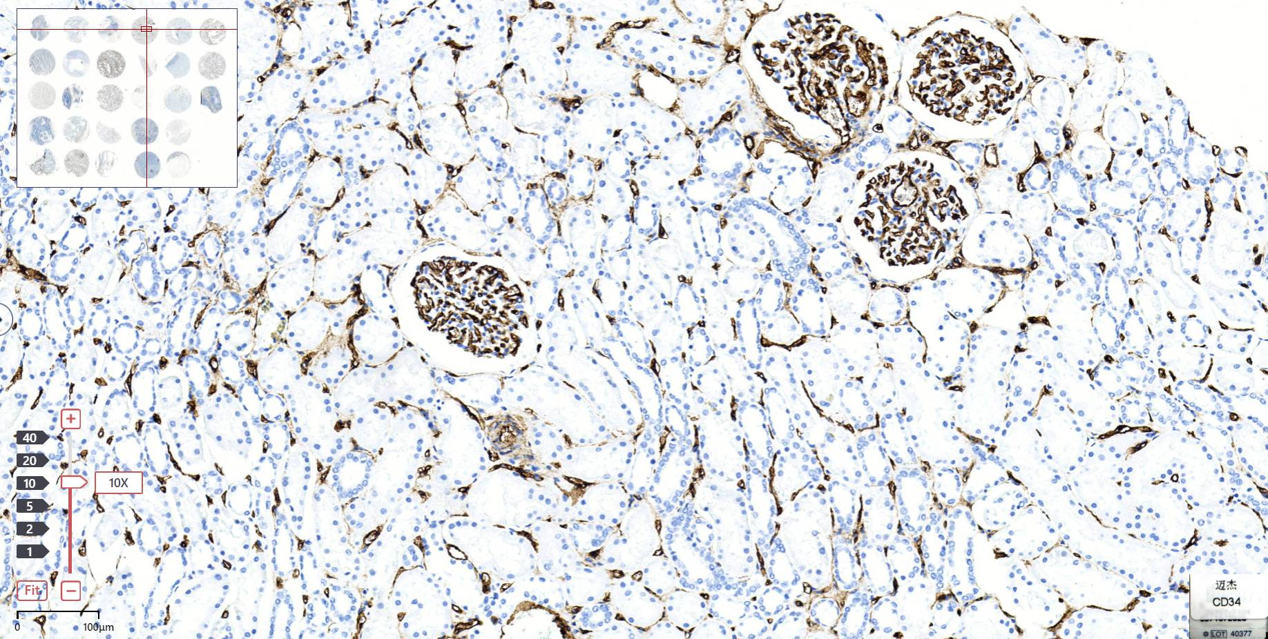 14 - CD34 AD80008