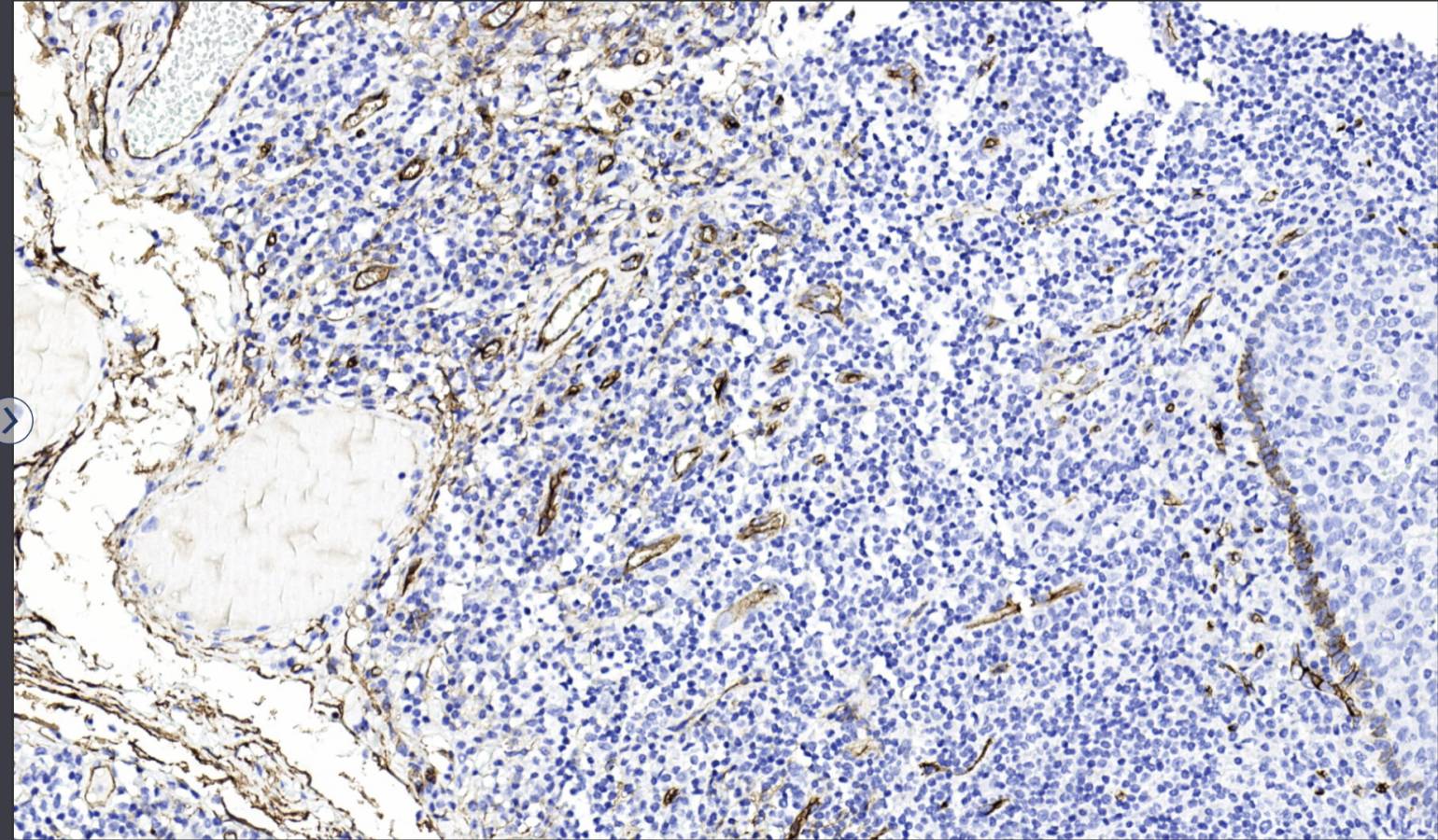 14 - CD34 AD80008