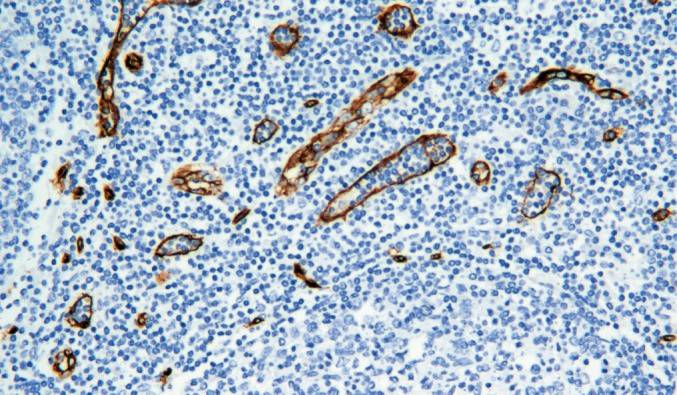 14 - CD34 AD80008