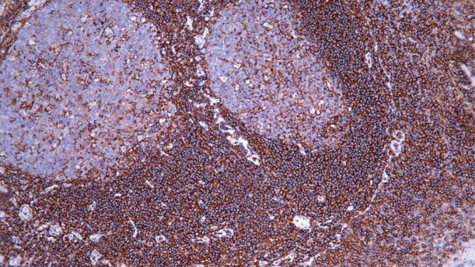 14 - CD44 AD80009