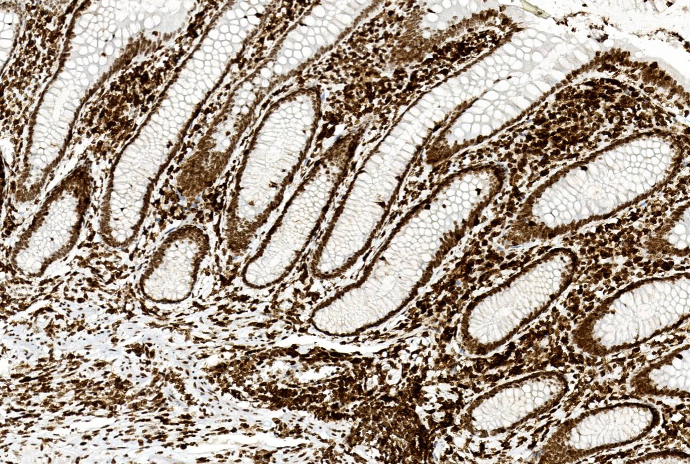 14 - CD45RO AD80011