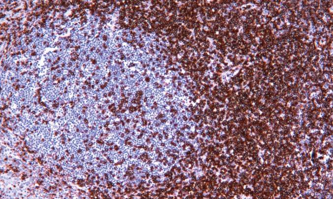 14 - CD45RO AD80011