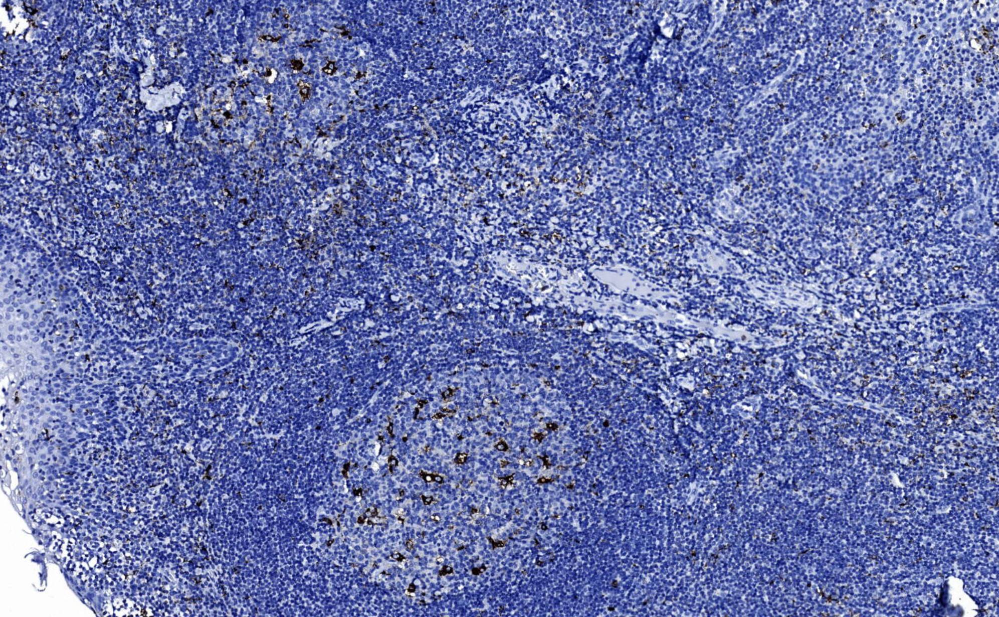 14 - CD68 AD80014