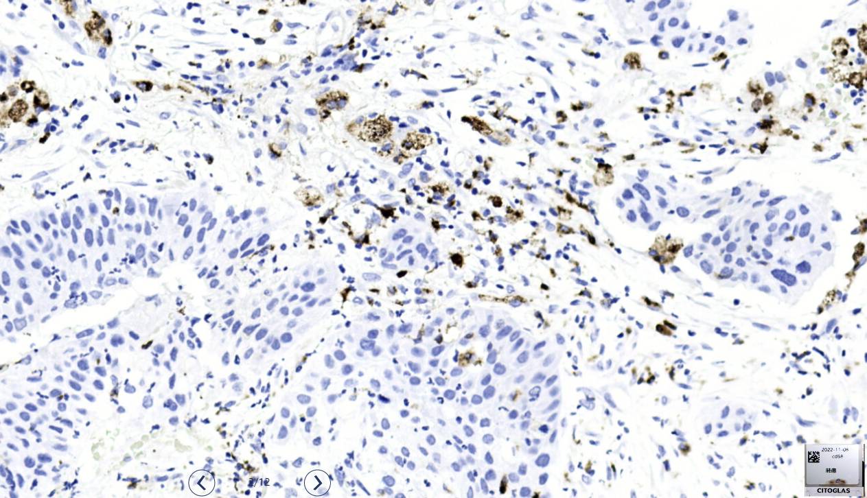 14 - CD68 AD80014