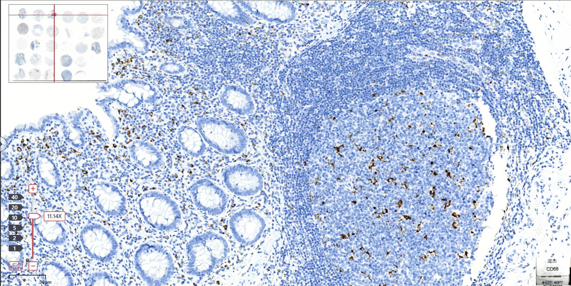14 - CD68 AD80014