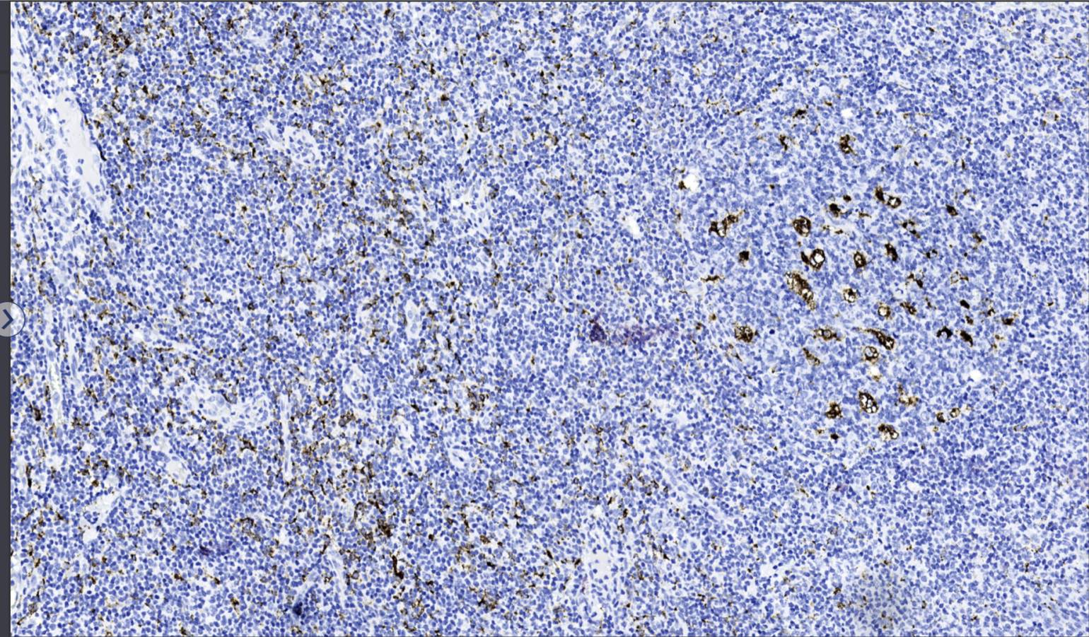 14 - CD68 AD80014