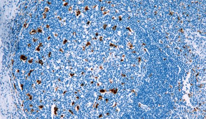 14 - CD68 AD80014