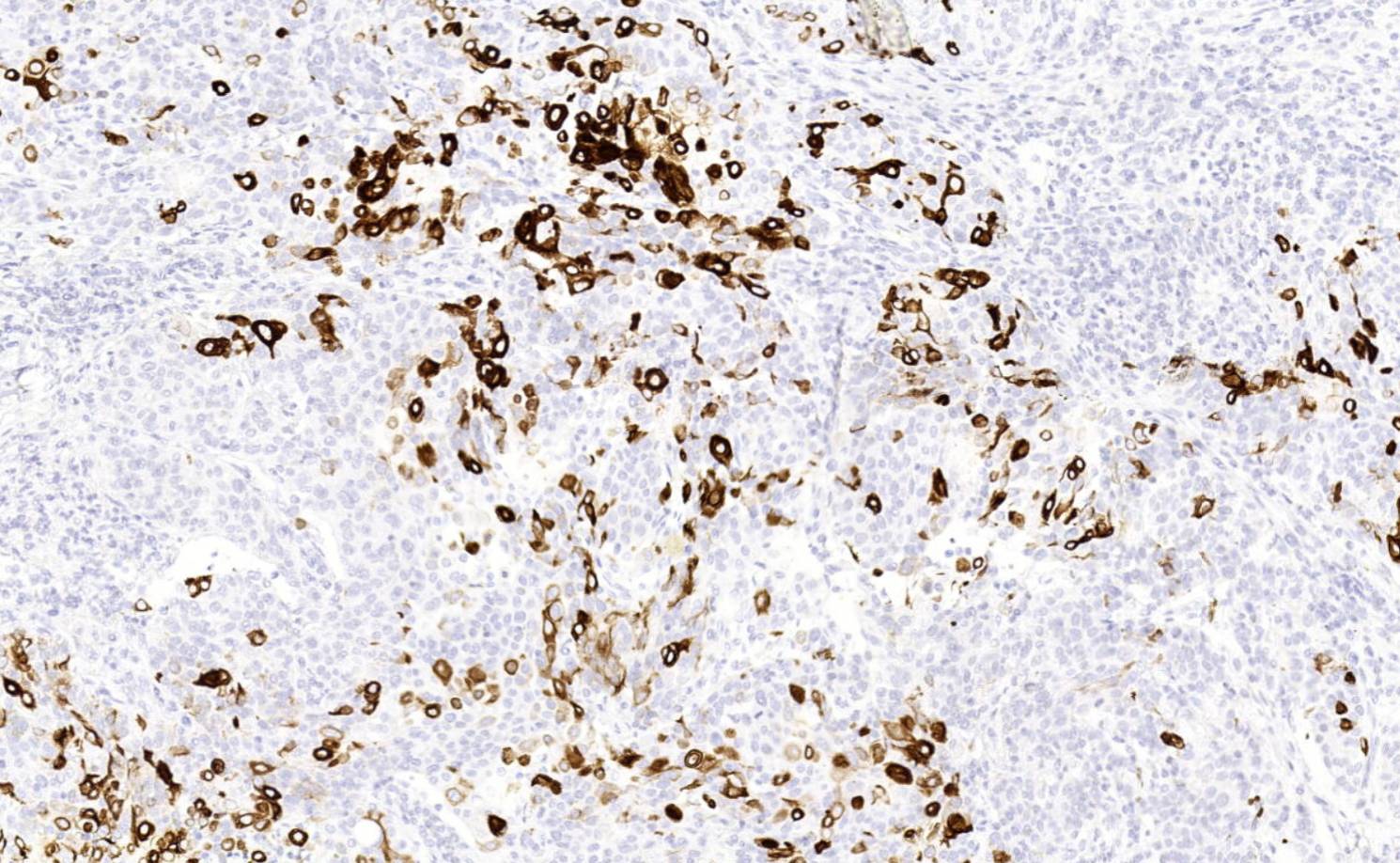 14 - CK17 AD80021