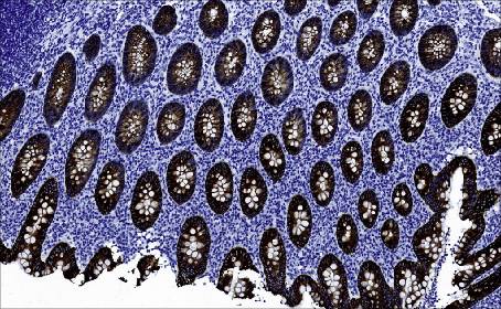 14 - CK19 AD80023