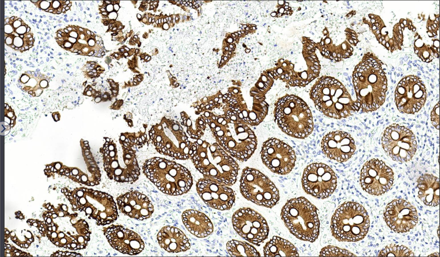 14 - CK20 AD80024