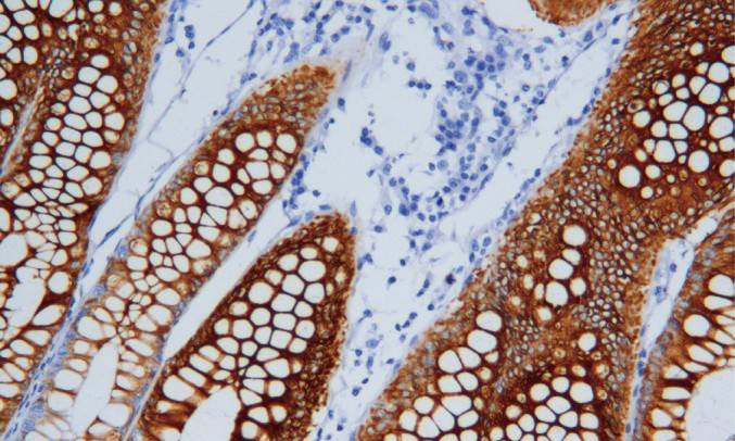14 - CK20 AD80024