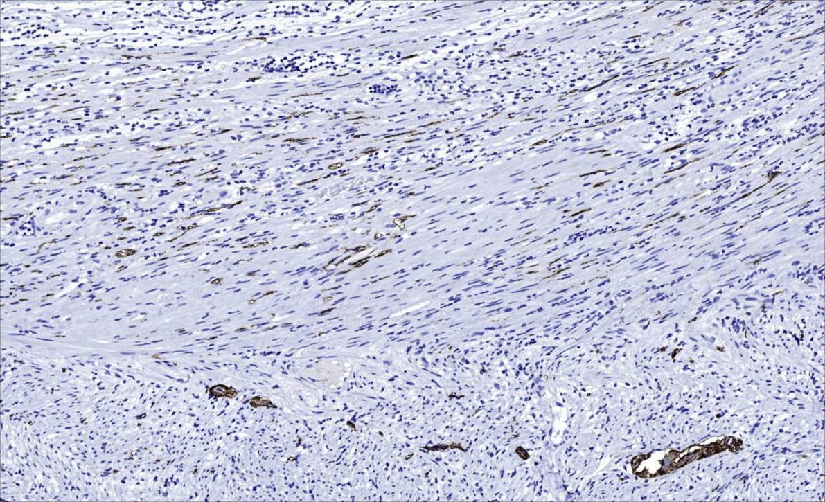14 - SYN AD80038
