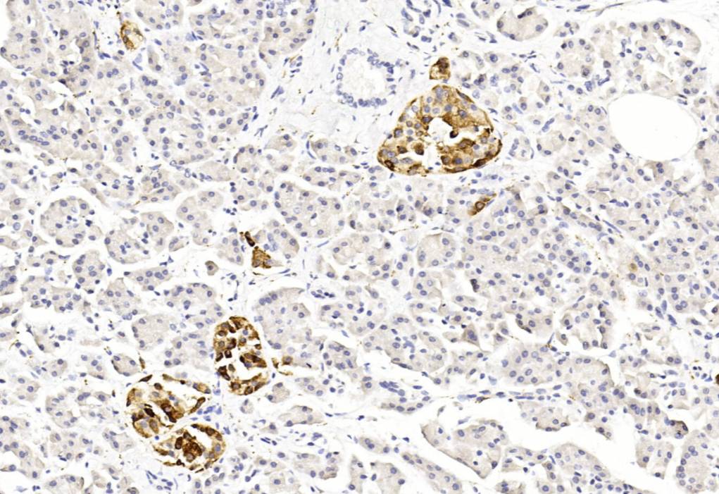 14 - SYN AD80038