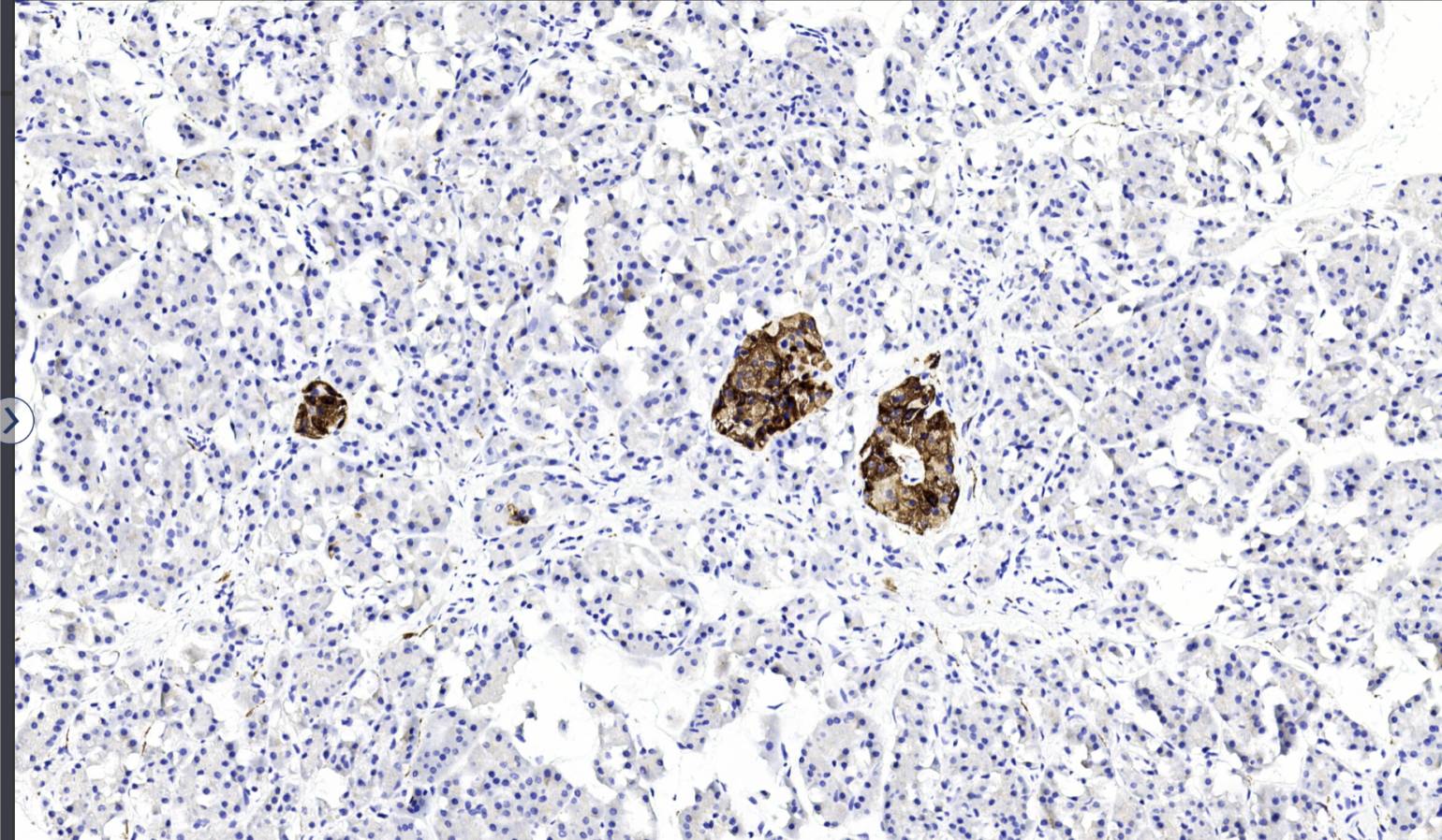 14 - SYN AD80038