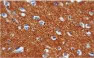 14 - SYN AD80038