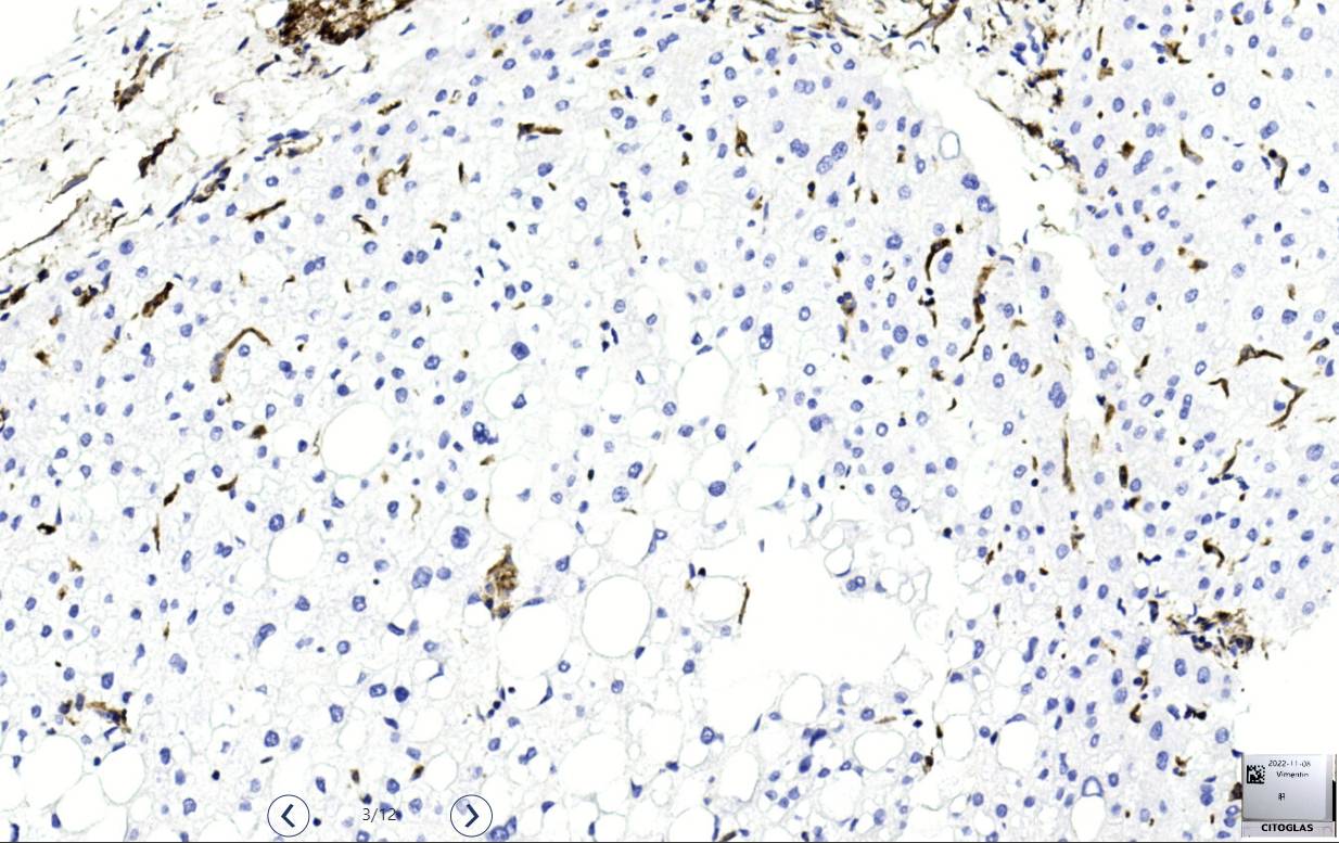14 - Vimentin AD80040