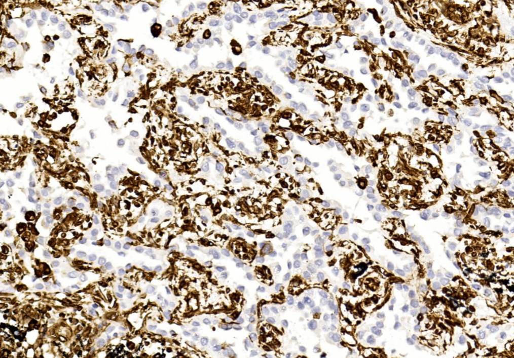 14 - Vimentin AD80040
