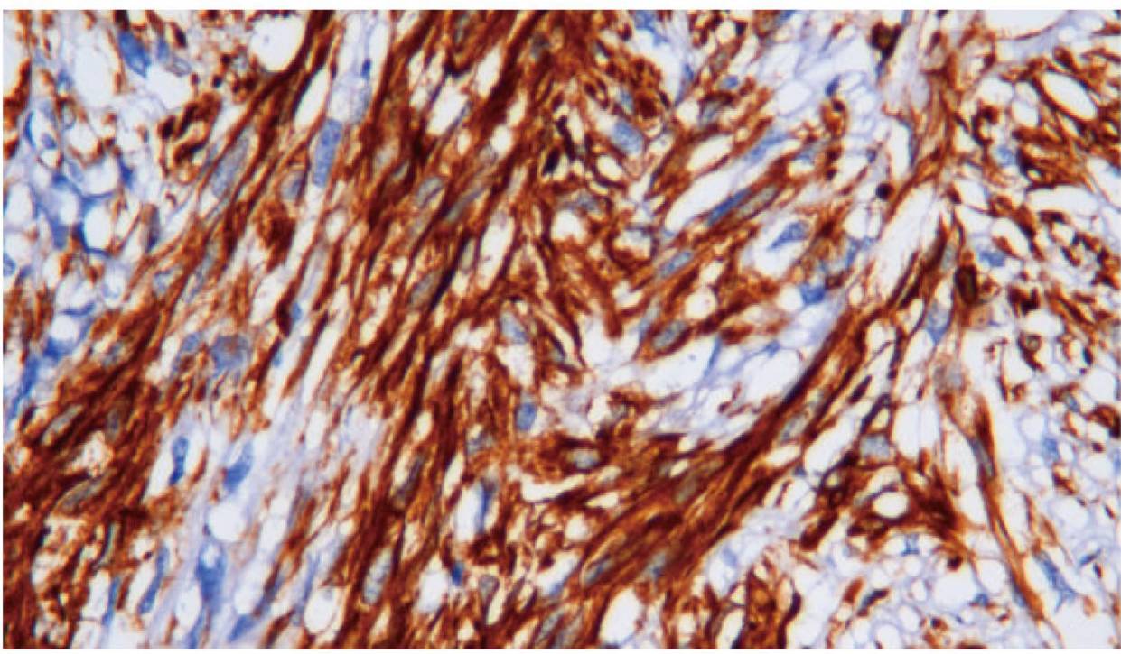 14 - Vimentin AD80040