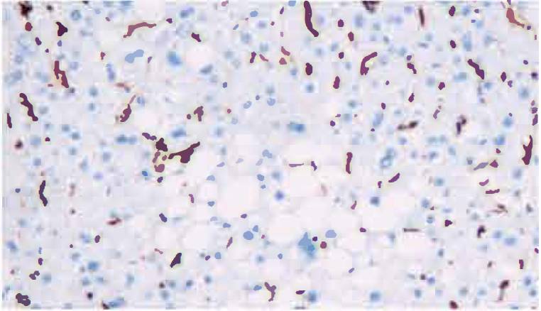 14 - Vimentin AD80040