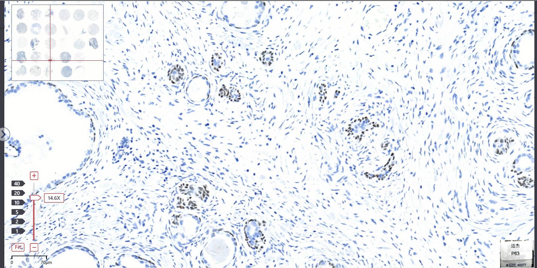 14 - p63 AD80046