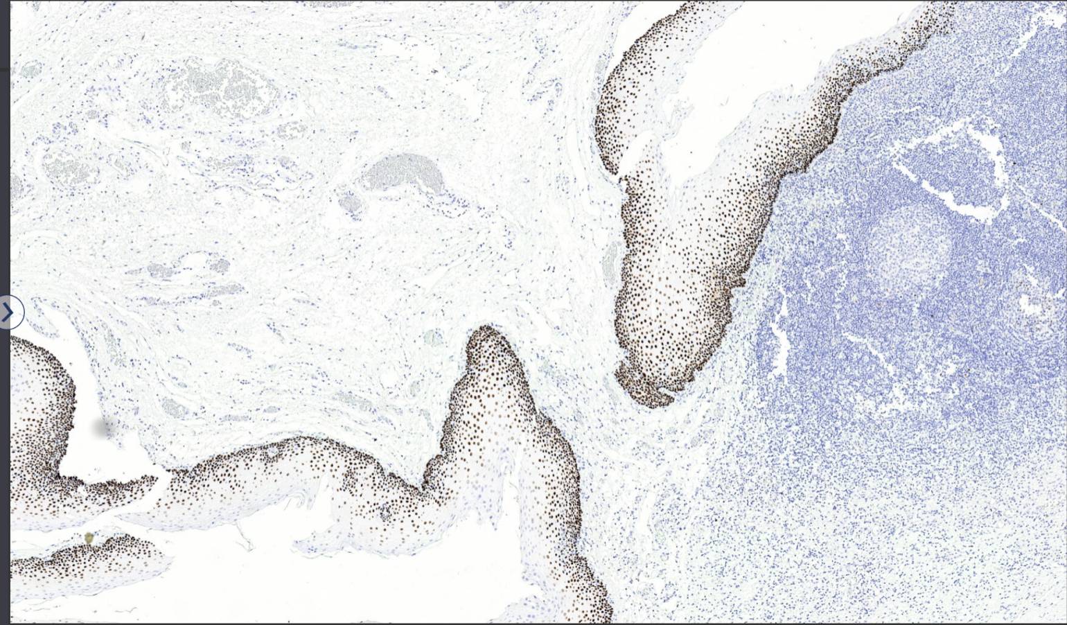 14 - p63 AD80046