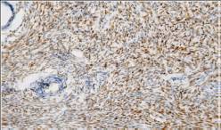 14 - Anti-SF-1 antibody AD80047