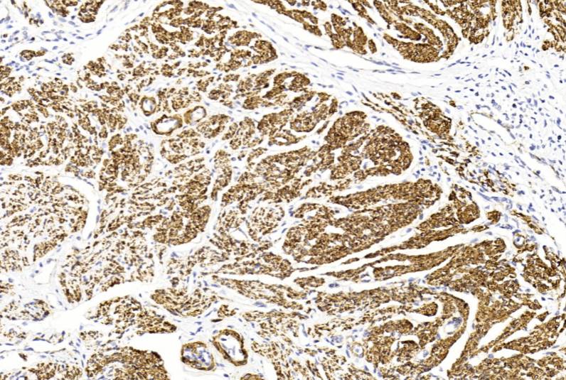 14 - Actin AD80049