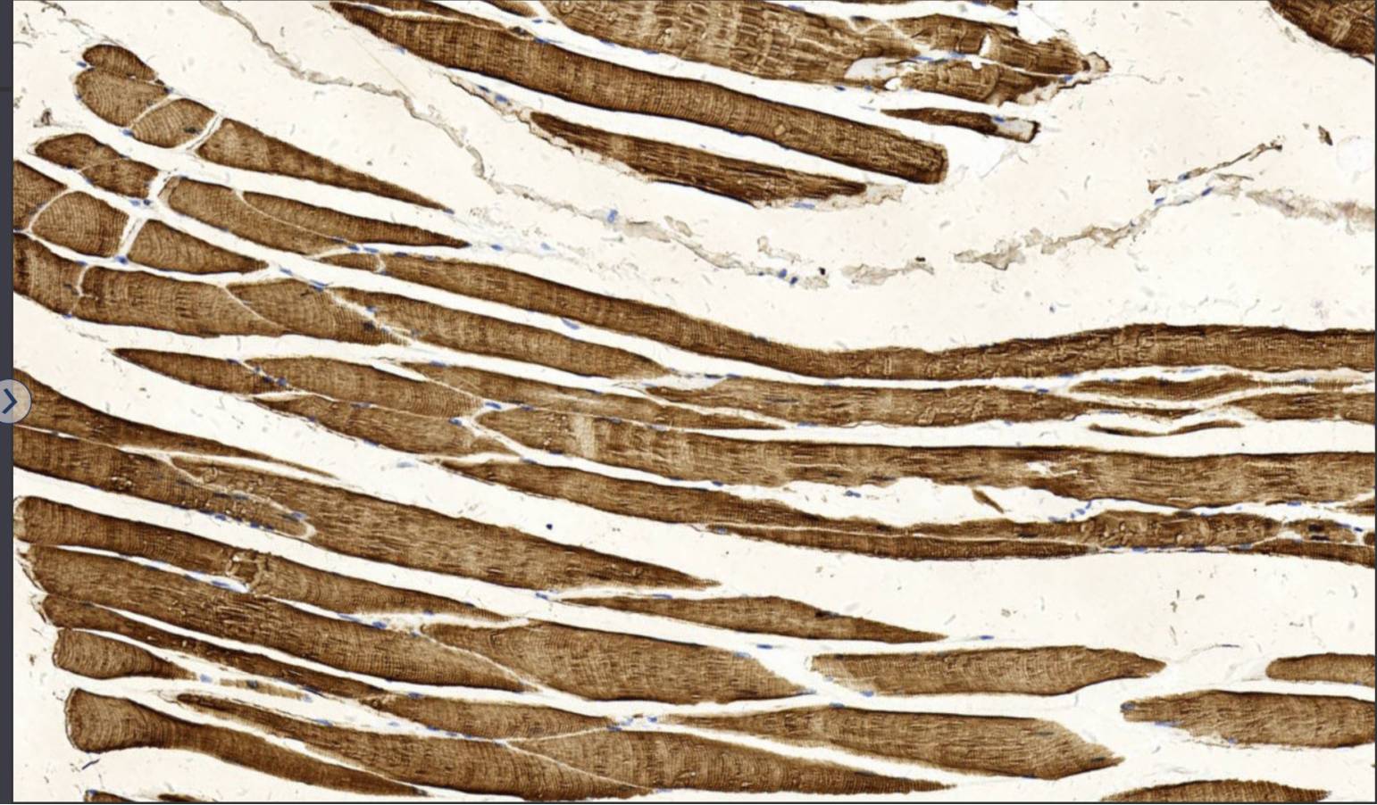 14 - Actin AD80049