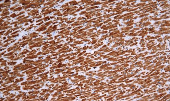 14 - Actin AD80049