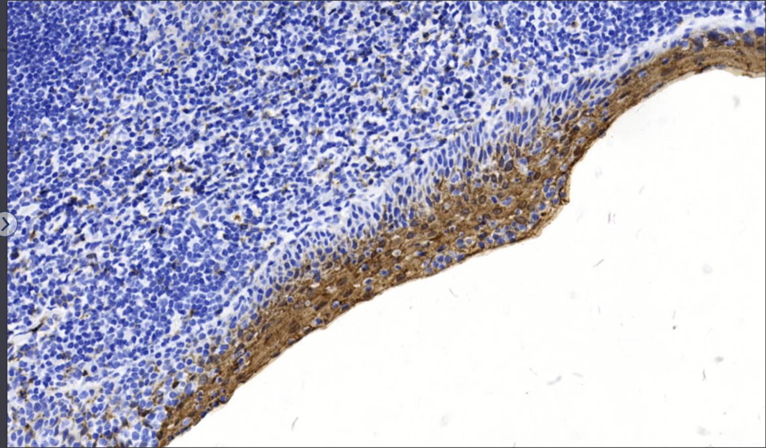 14 - Annexin A1 AD80052