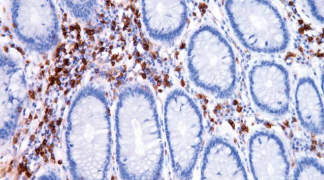 14 - Annexin A1 AD80052