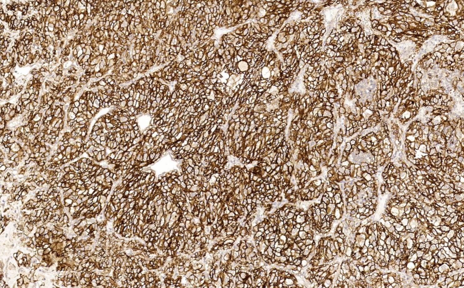 14 - CA IX 9 AD80054