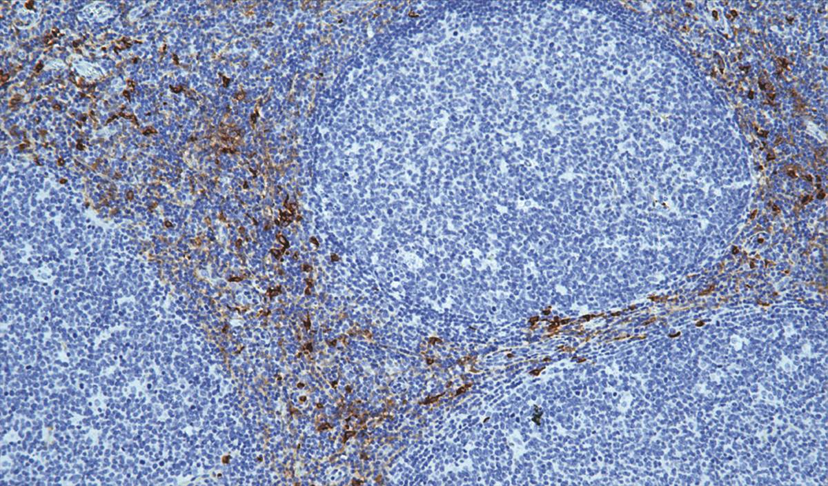 14 - CD13 AD80057