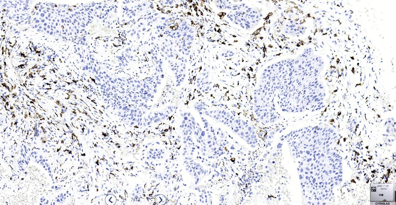 14 - CD163 AD80059