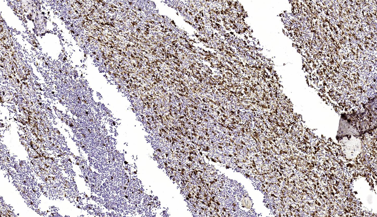 14 - CD163 AD80059
