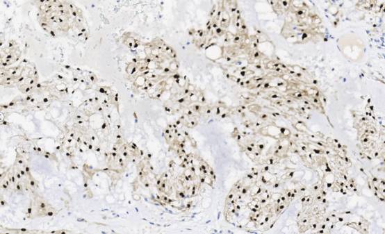 14 - Brachyury antibody AD80062