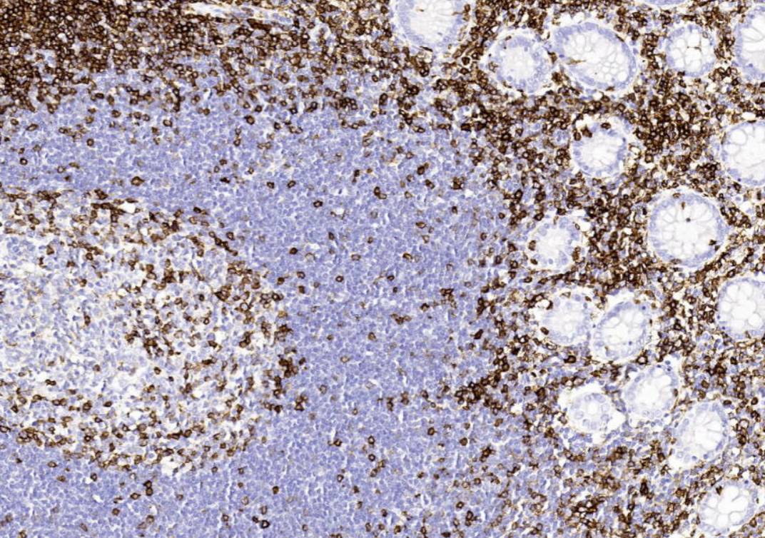 14 - CD43 AD80063