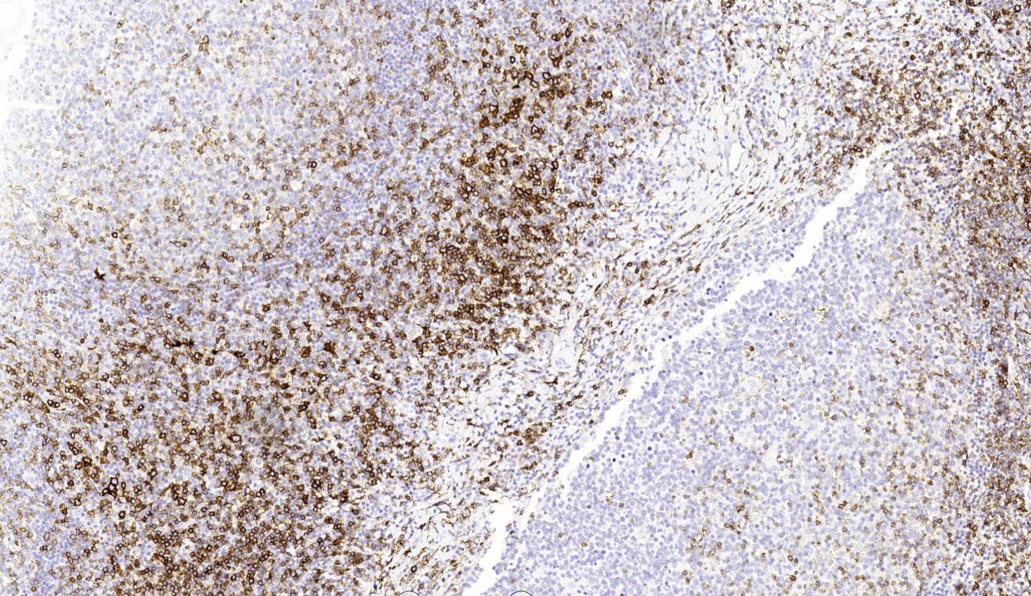14 - CD43 AD80063