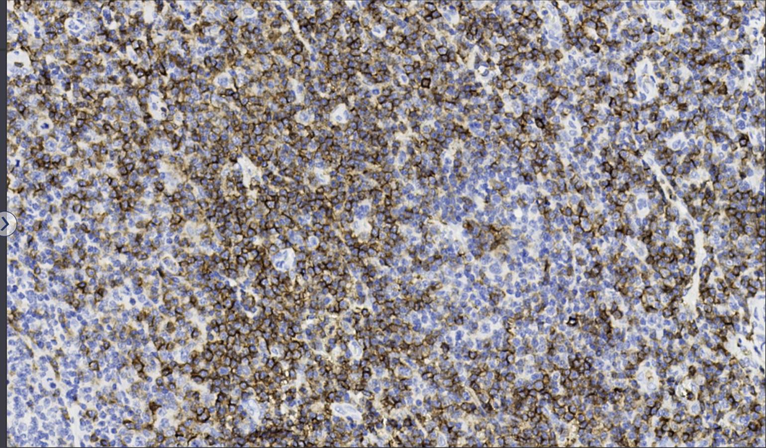 14 - CD43 AD80063
