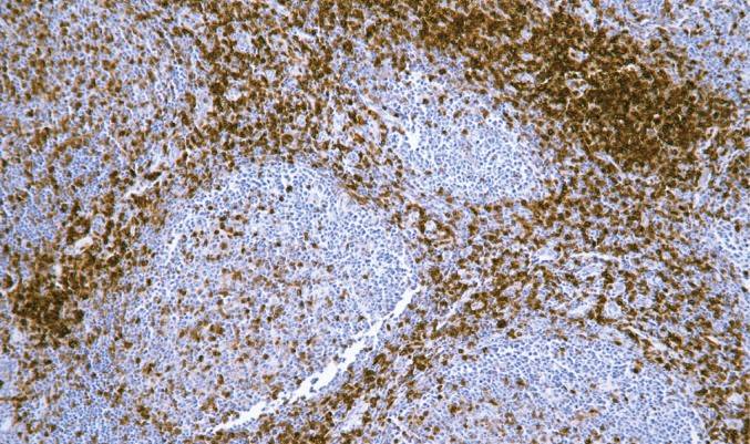 14 - CD43 AD80063