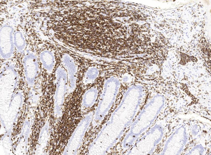 14 - CD45 AD80064
