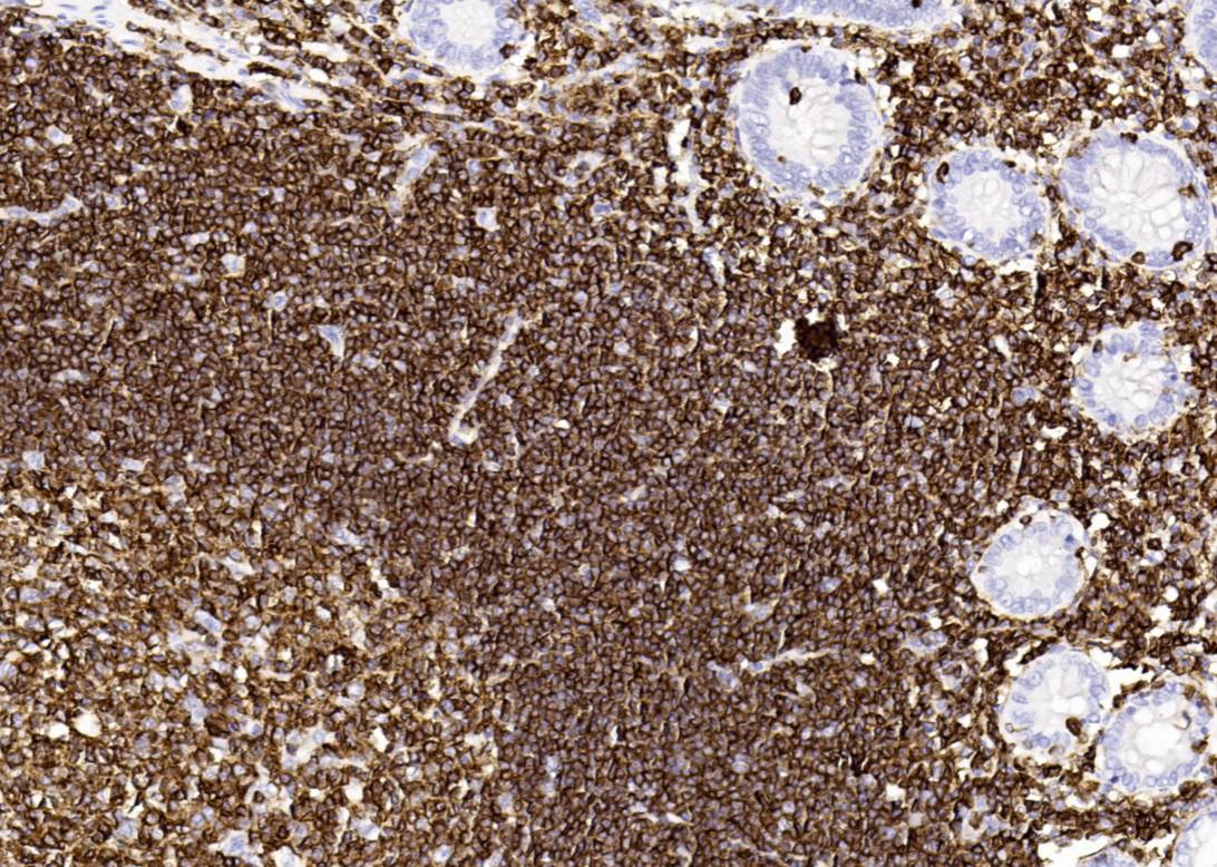 14 - CD45 AD80064