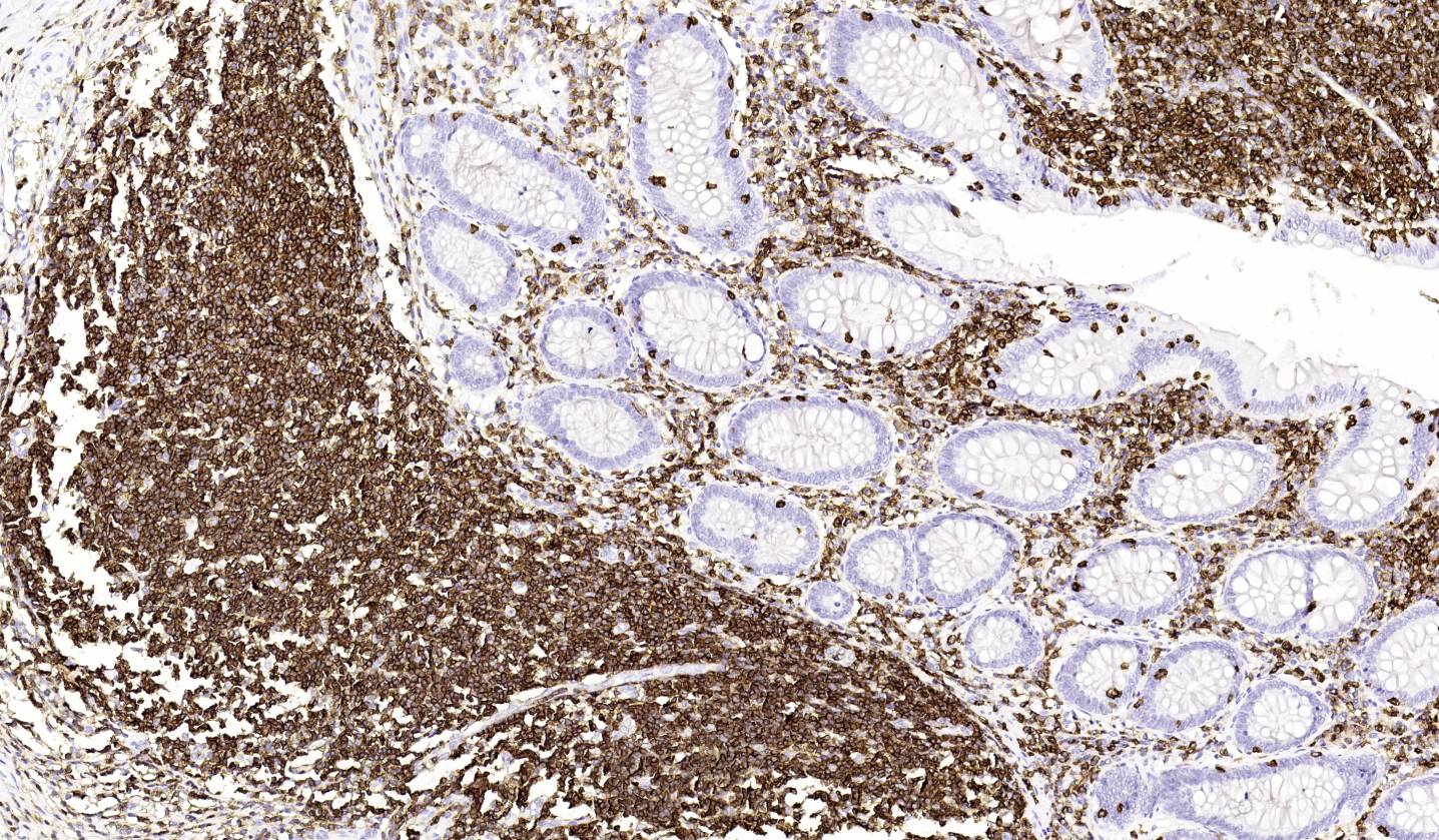 14 - CD45 AD80064