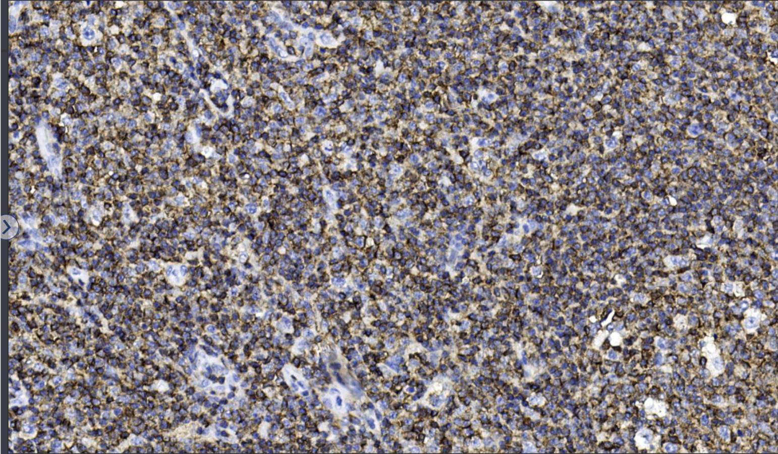 14 - CD45 AD80064