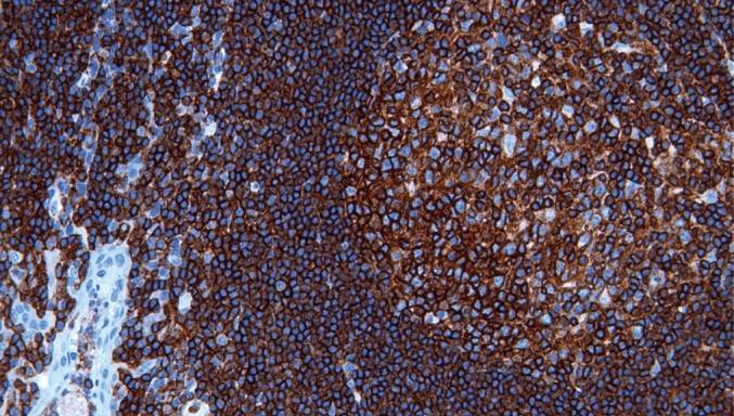 14 - CD45 AD80064
