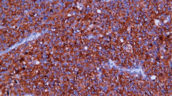 14 - CD63 AD80065